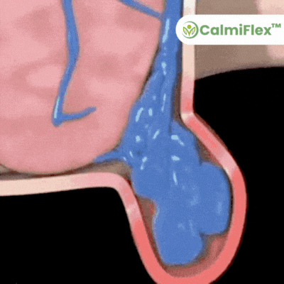 CalmiFlex Eliminates 99% of Hemorrhoids from the First Application image CalmiFlex Eliminates 99% of Hemorrhoids from the First Application