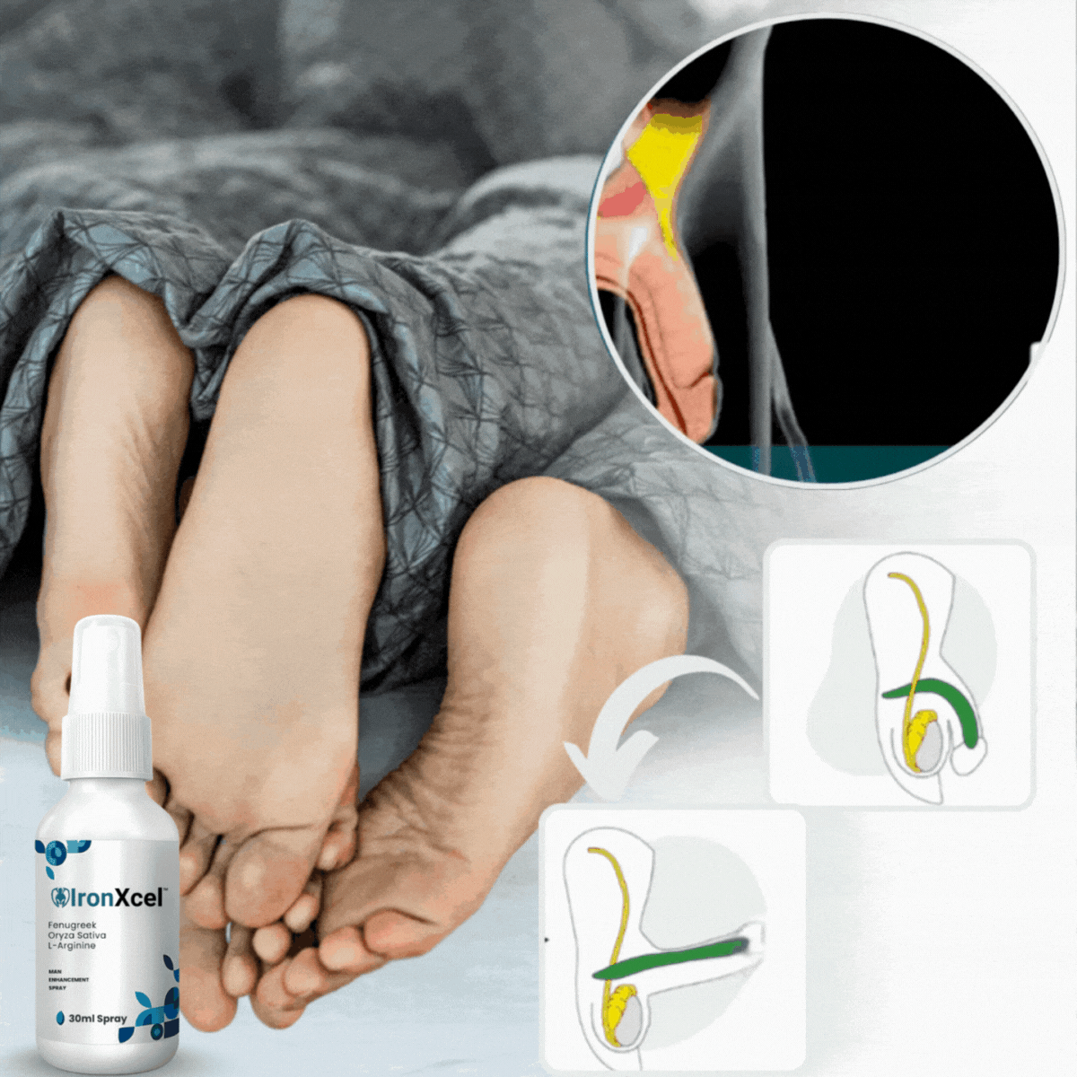 IronXcel™ Algae Erection Spray 20 1766737341 uk%20%282%29