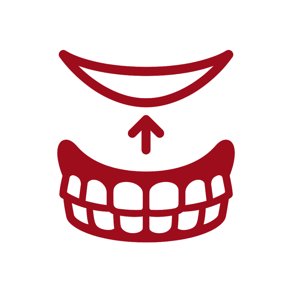 ProDent™ Thermoplastic Denture Adhesive