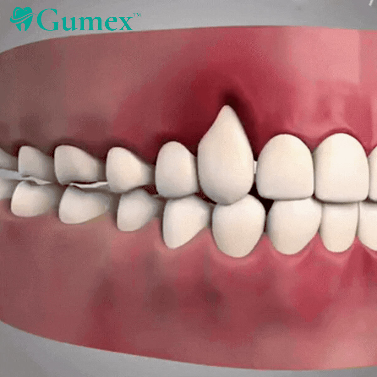 Gumex™ Gum Protect Repair Toothpaste image Gumex™ Gum Protect Repair Toothpaste