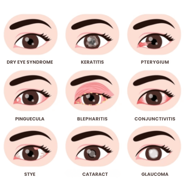 Oyox™ Vision-Enhancing Drops 20 1739878630 uk