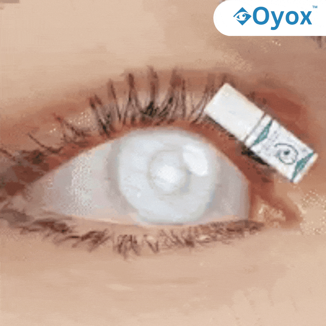 Oyox™ Vision-Enhancing Drops 16 1739884408 1