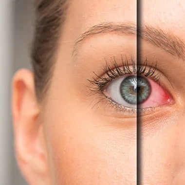 Oyox™ Vision-Enhancing Drops 17 1739884423 1737156566 irriter