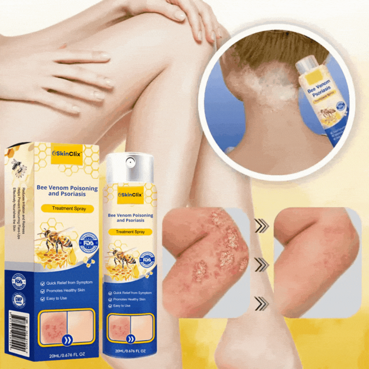 SkinClix™ | Effectively relieves itching and flaking and improves the appearance 28 SkinClix™ | Effectively relieves itching and flaking and improves the appearance