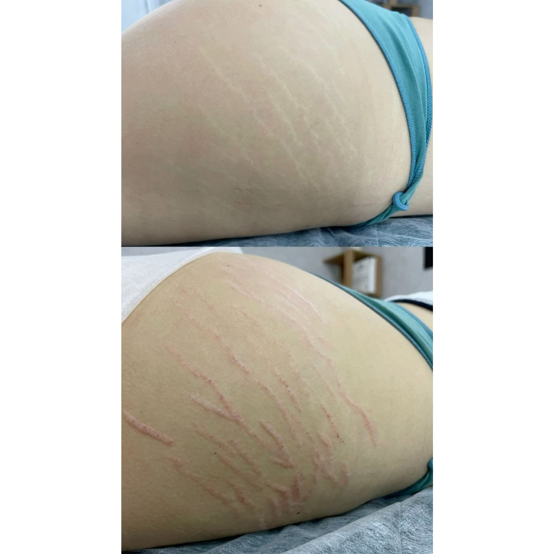 Testimonianza Oro Sublime 12