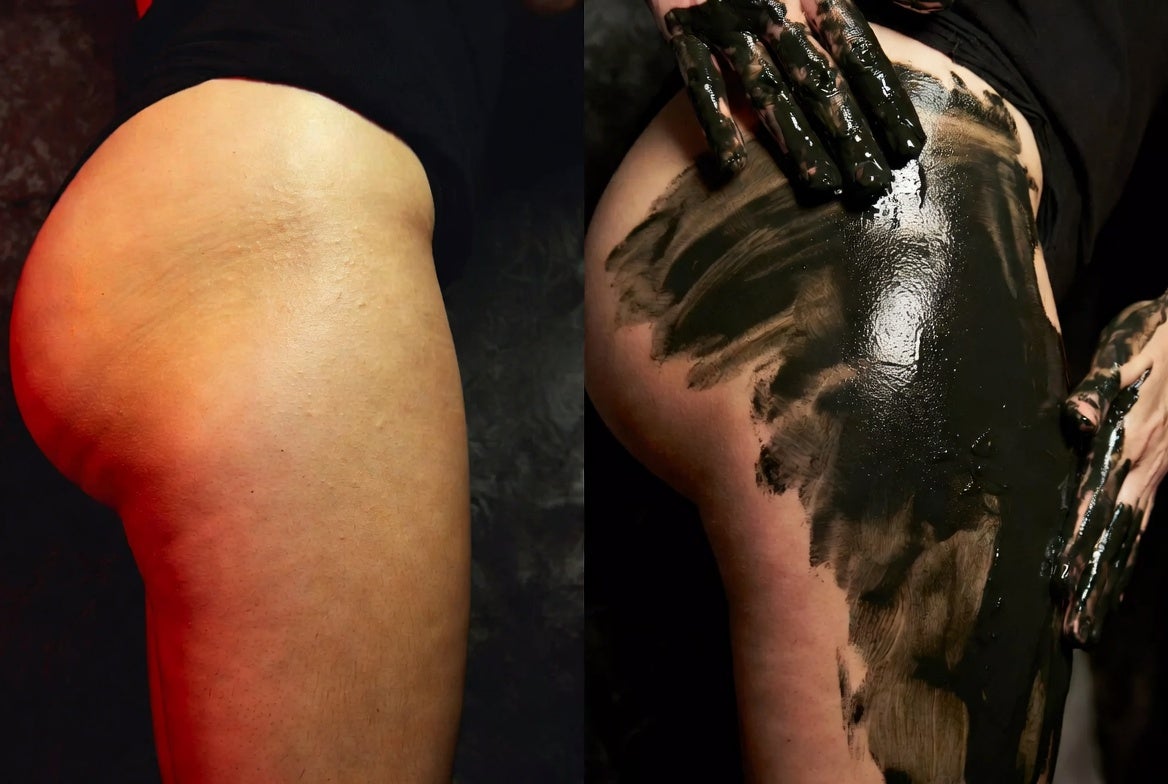 Trattamento corpo Magma per pelle a buccia d'arancia e inestetismi