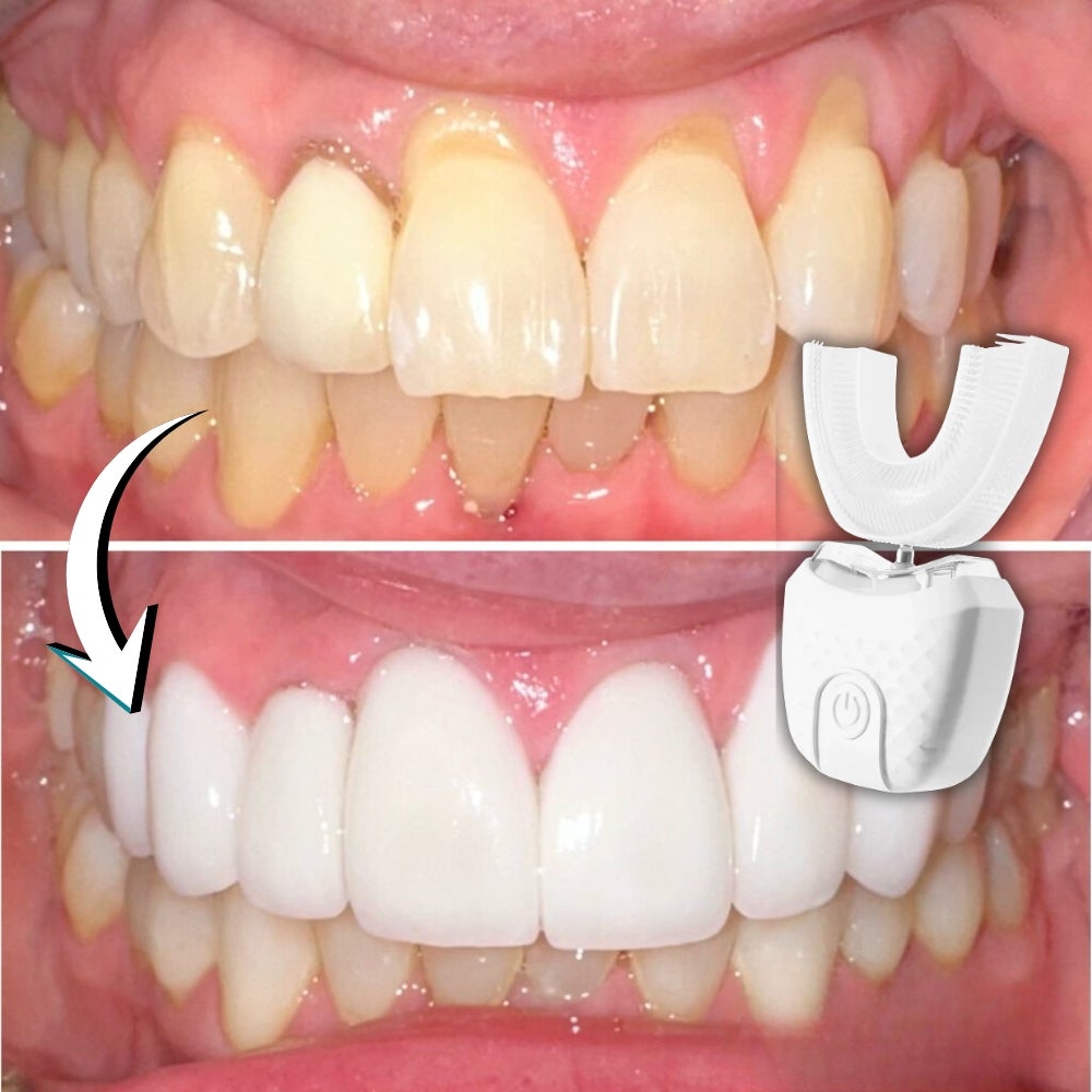 DentaShine™ | Destroys 99.9% of bacteria, delivering clean white teeth in 30 seconds. image DentaShine™ | Destroys 99.9% of bacteria, delivering clean white teeth in 30 seconds.