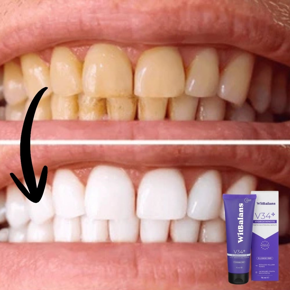 WitBalans™ V34 Toothpaste | Whitens teeth in 60 seconds