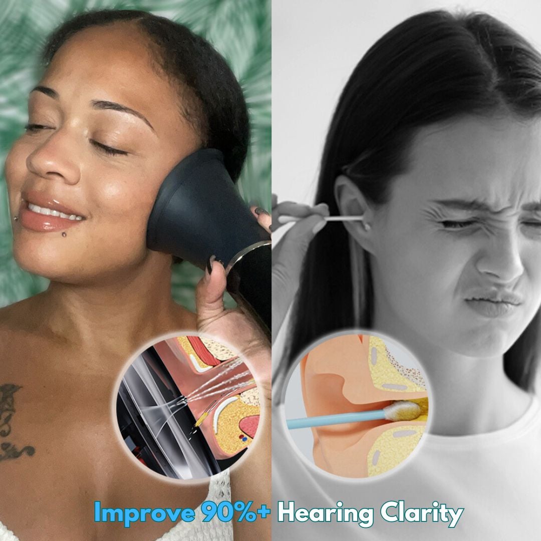 10 Reasons Why the Voldic™ Electric Ear Wax Removal Kit Enhances Your ...