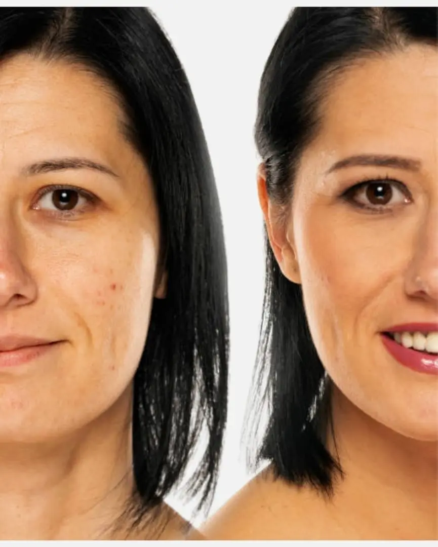 Antes y Después 5