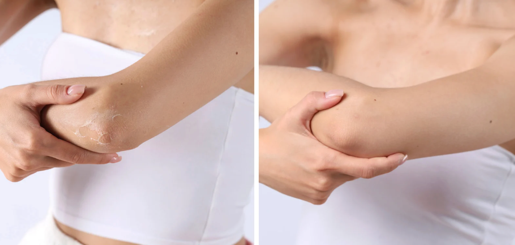 Grafik der Hautbarriere