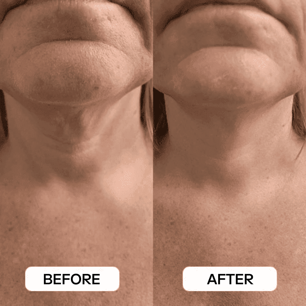 Before and after result
