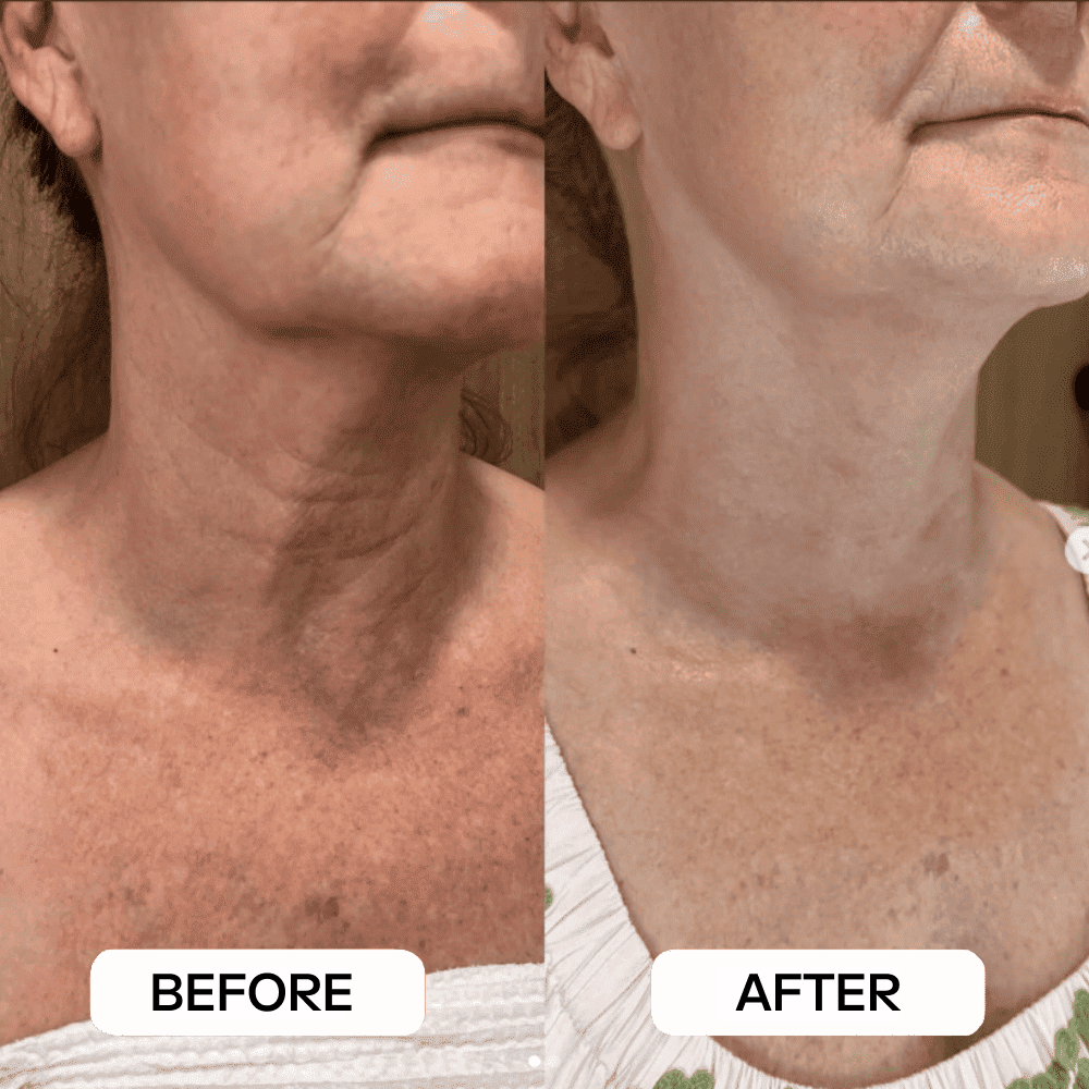 Before and after result
