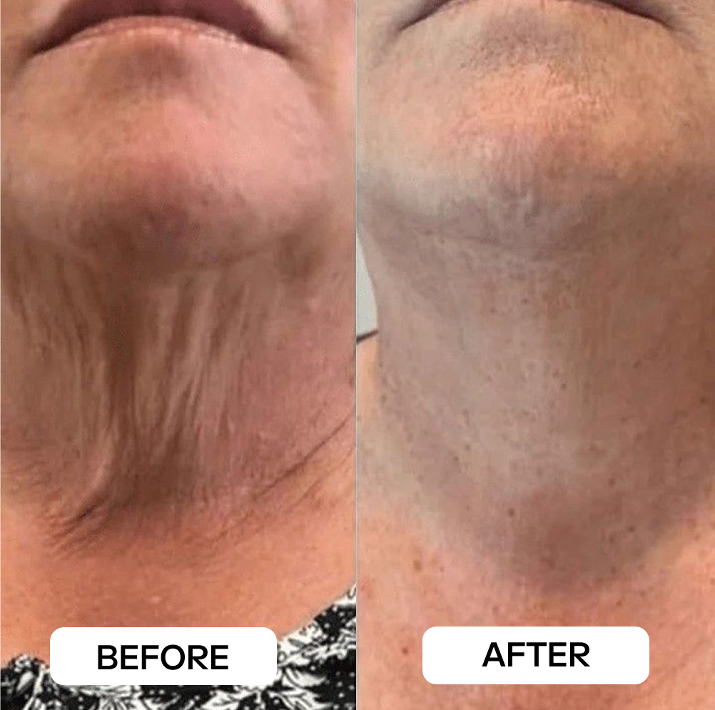 Before and after result
