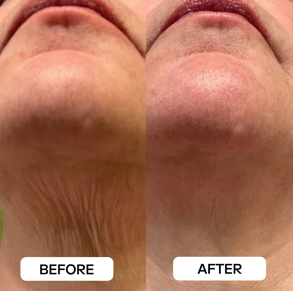 Customer Result