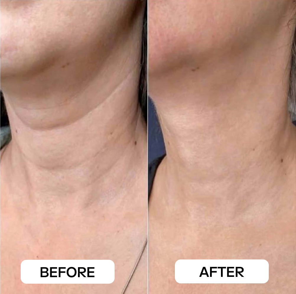 Customer Result