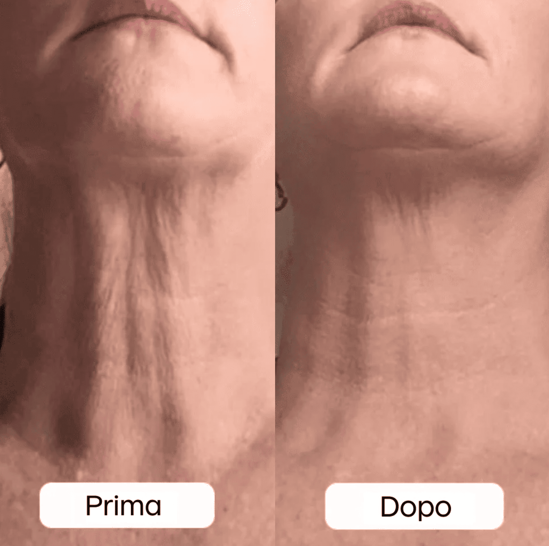 Photo avant-après Giulia