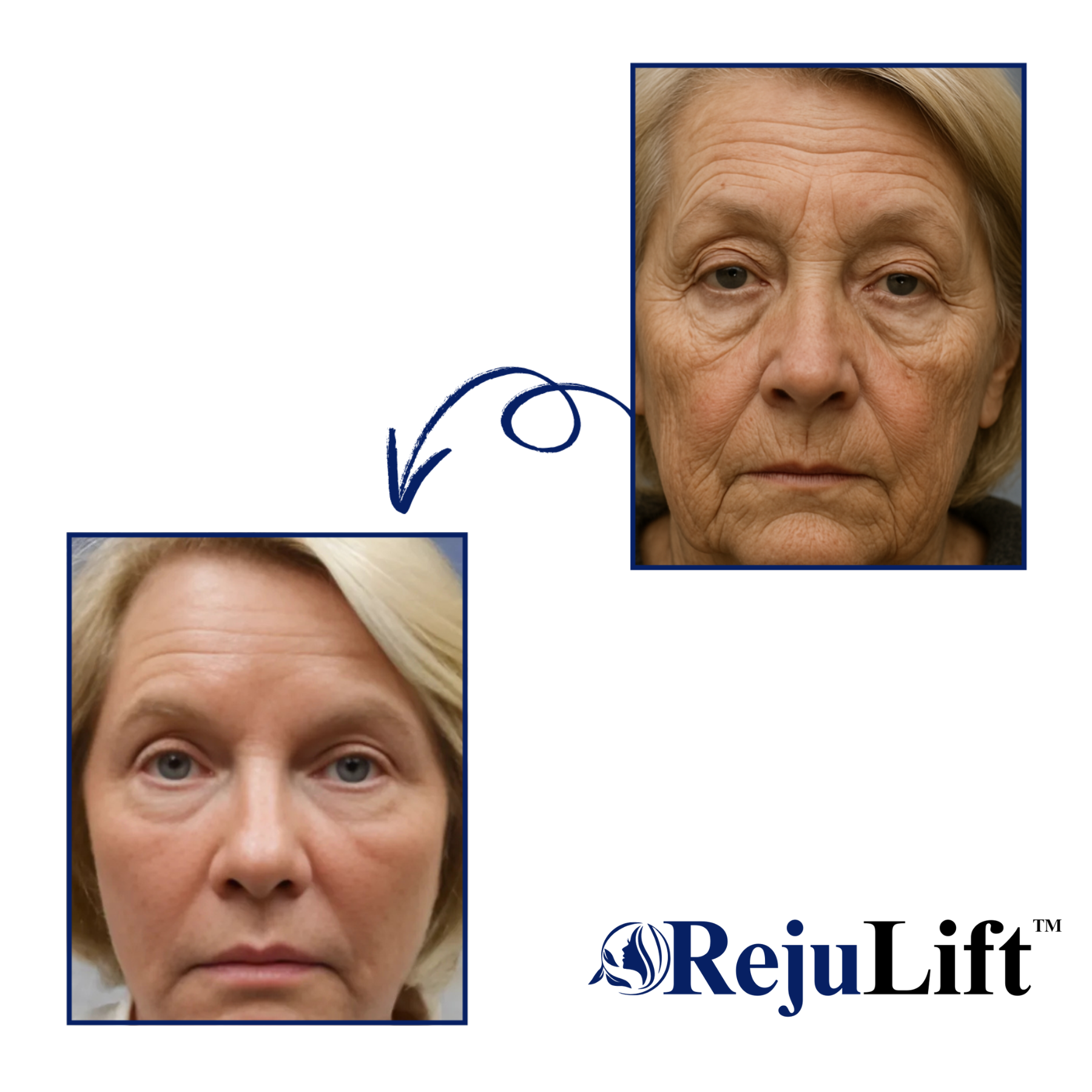 RejuLift™ Lifting Serum | Facelift without Botox 14 RejuLift™ Lifting Serum | Facelift without Botox