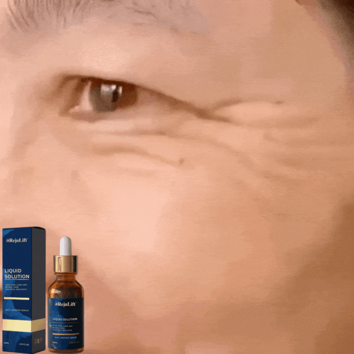 RejuLift™ Lifting Serum | Facelift without Botox 13 RejuLift™ Lifting Serum | Facelift without Botox
