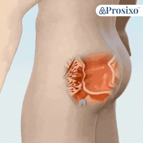 1759743526 South%20Africa%E2%80%99s%20top%20choice%20for%20prostate%20relief