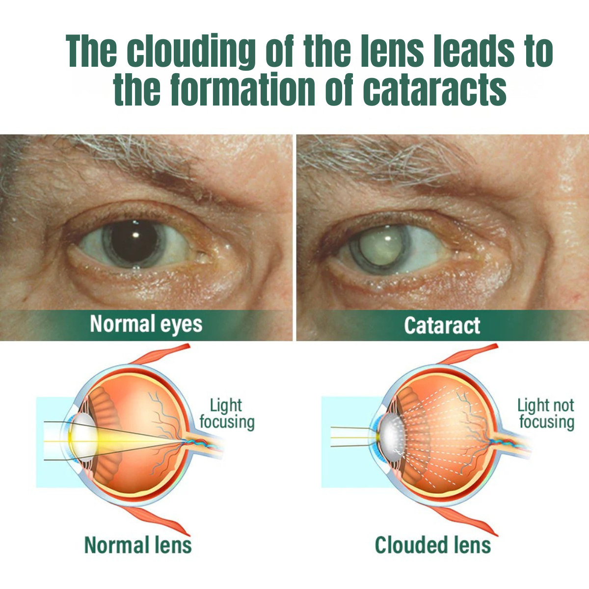 OptiNano™ Eye Drops