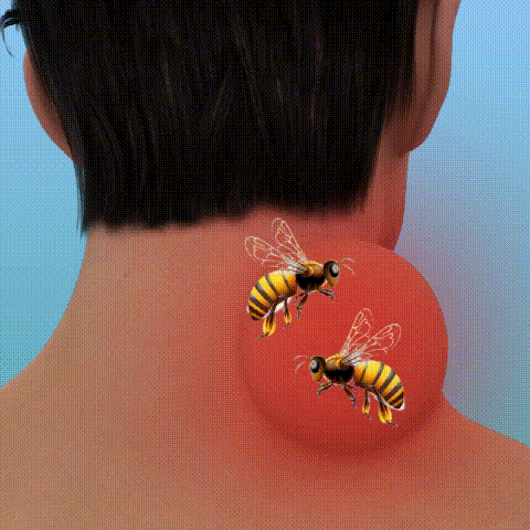 BeeMend™ | Eliminate joint pain and swelling