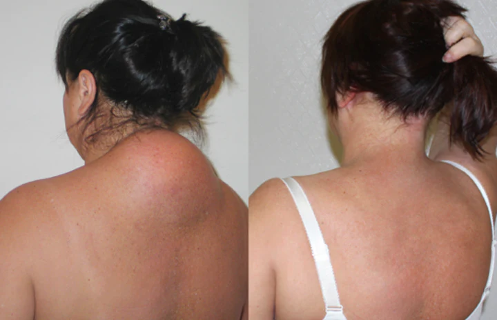 BeeMend™ | Eliminate joint pain and swelling