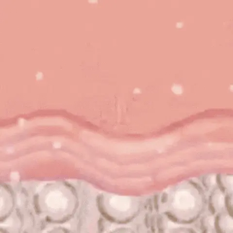 Dentova™ | Reverse 93% of Gum Recession in Just 7 Days