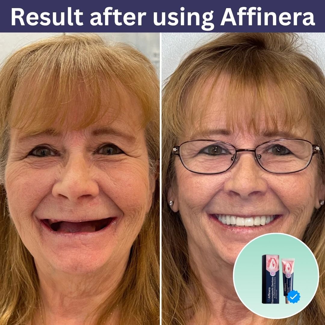 Affinera™ Secure hold without daily glue in 3 days image Affinera™ Secure hold without daily glue in 3 days