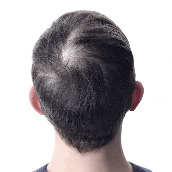 Resultados após 30 dias