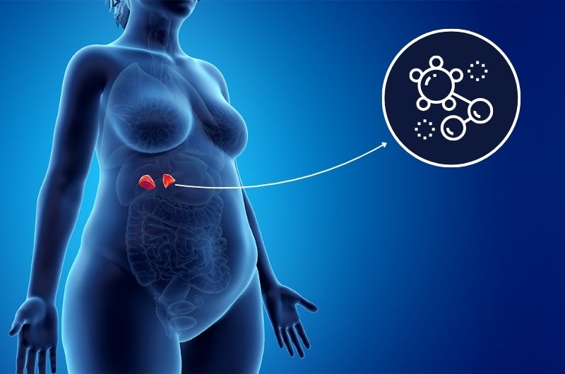 Ce este cortizolul și de ce determină creșterea în greutate?  