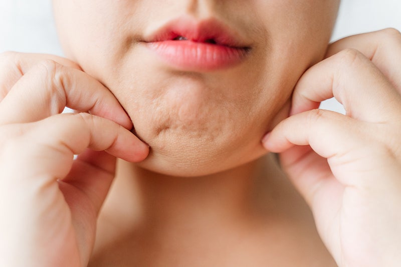 Știai? Fapte surprinzătoare despre cortizol  