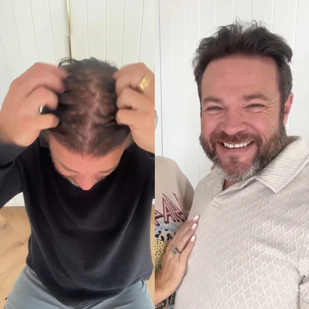 Transformation photo