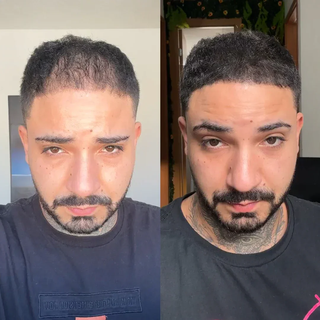 Transformation photo