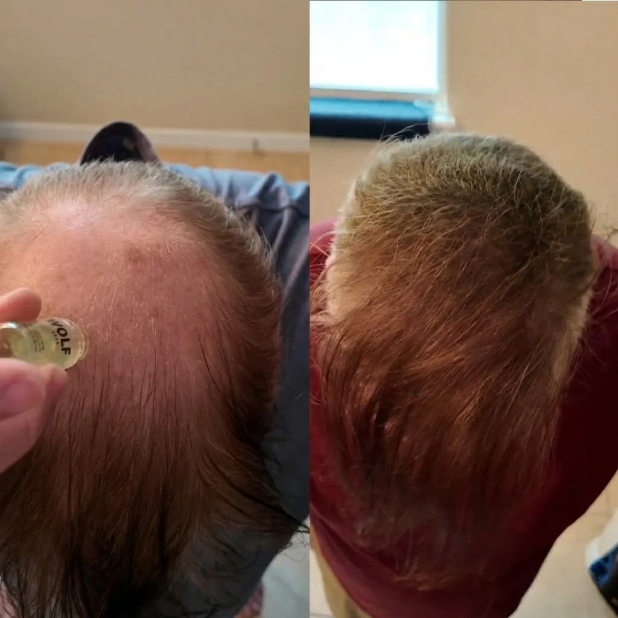 Transformation photo