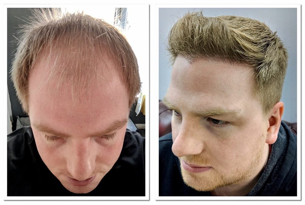 Foto de transformación