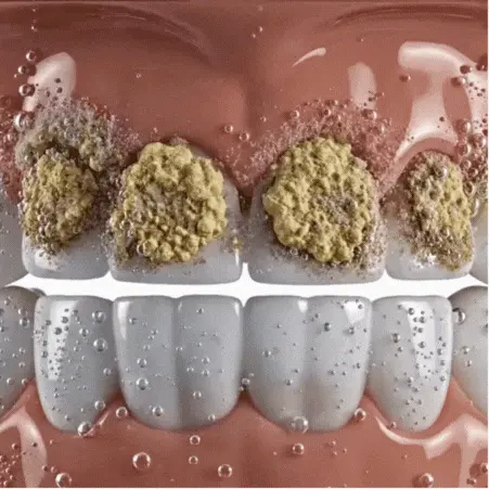 DentaClean™ | Sparkling, clean dentures in 5 minutes