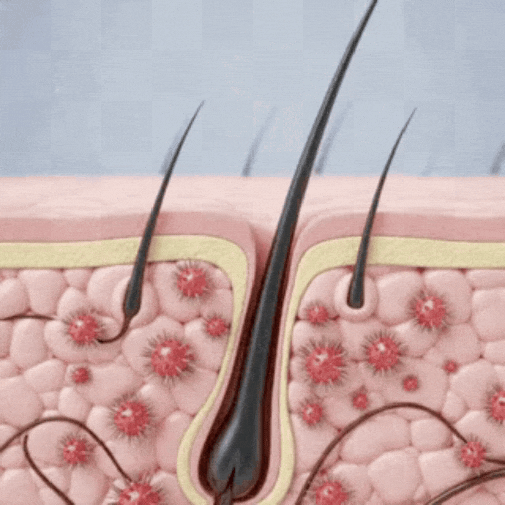 Salicylsyre for glat hud