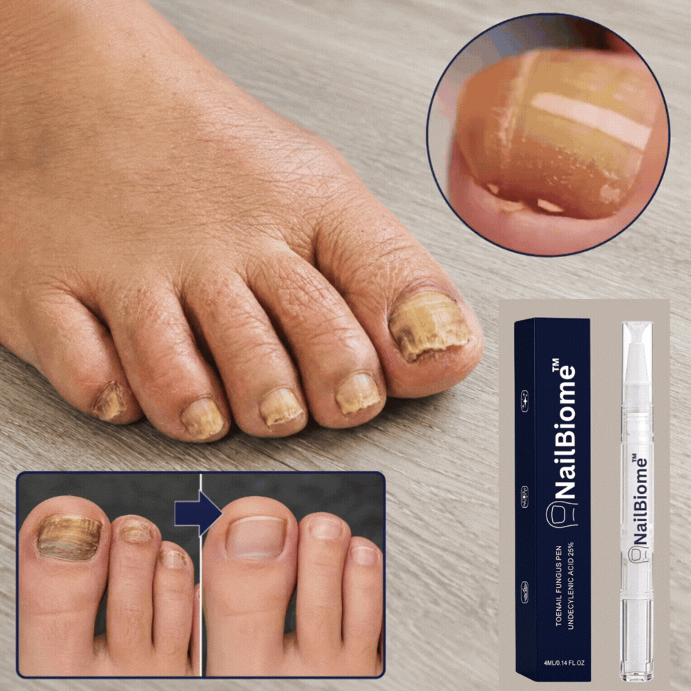NailBiome™