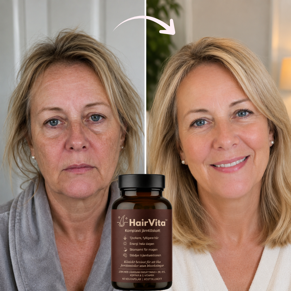 Før og efter HairVita™