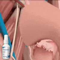 PrimeFlow™ spray