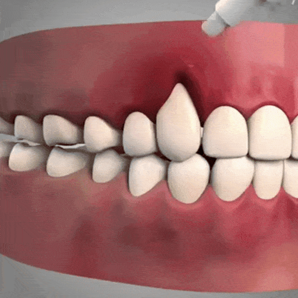 BioGum™ | Eliminate tooth pain and bleeding gums & restore your smile in just 7 days 9 1766471935 9cd9bed1826b4cc08a3385c9f3c8fd64 ezgif.com optimize