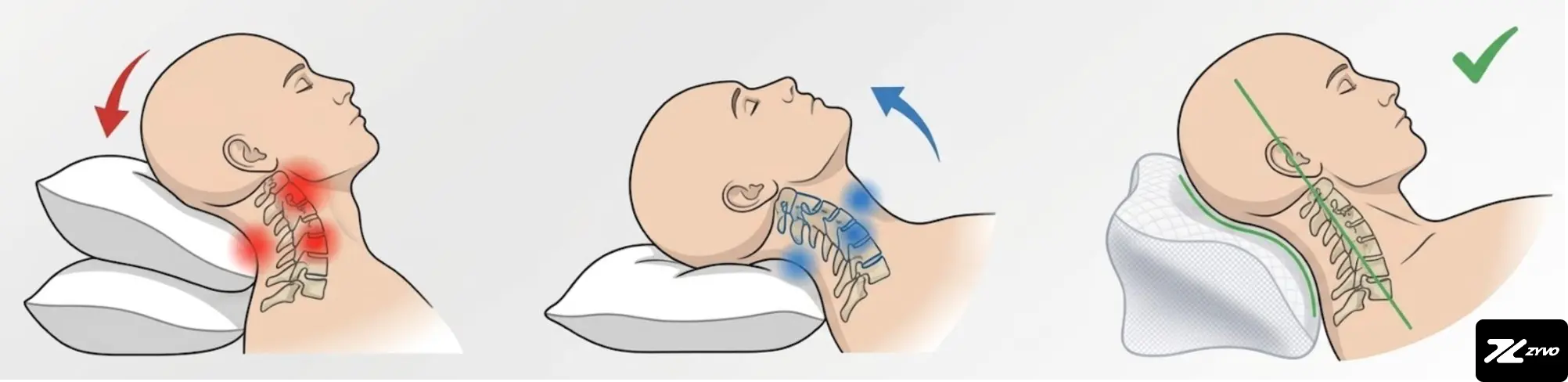 Wirbelsäulen-Ausrichtung mit ZYVO Rest Pillow