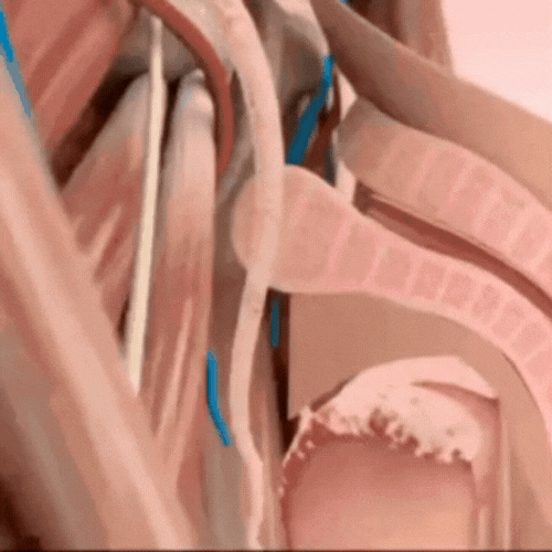 ErectaPlus GIF
