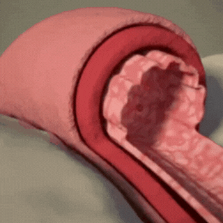 Arterion® Heart Health Circulation + Blood Flow